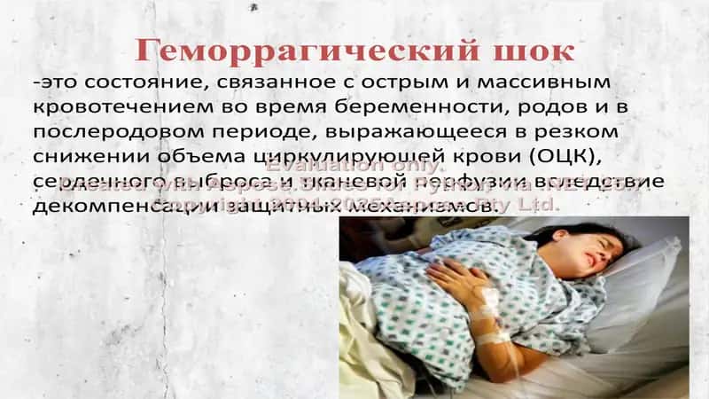 Геморрагический шок в акушерстве 2