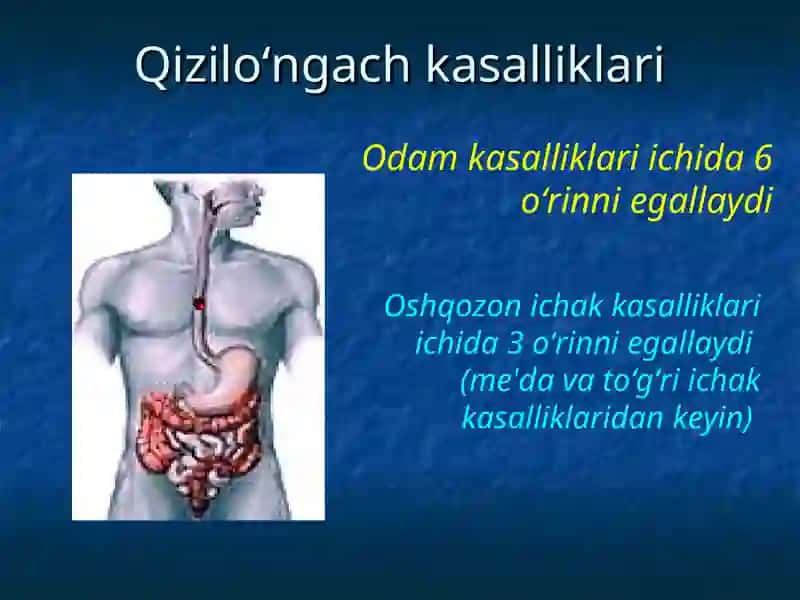 bolalarda qizilo'ngach kuyishi va yot jismlari 2
