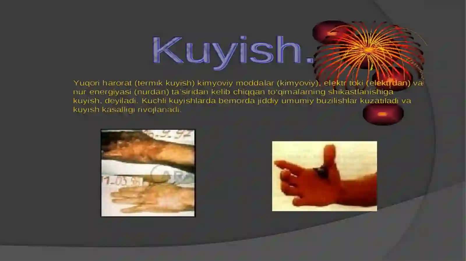 Kuyish turlari 2