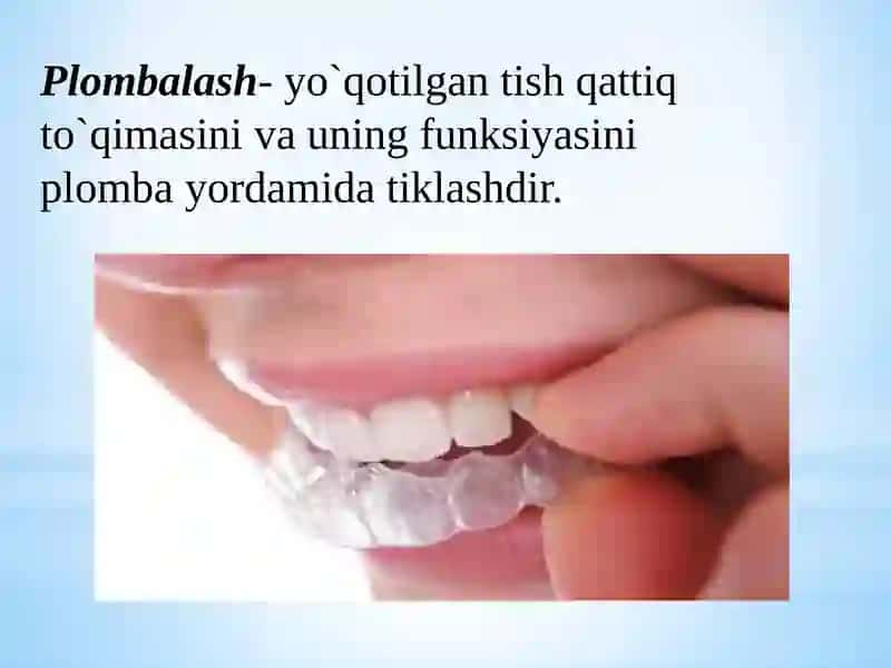 Zamonaviy Kompozit Plombaashyolari 2