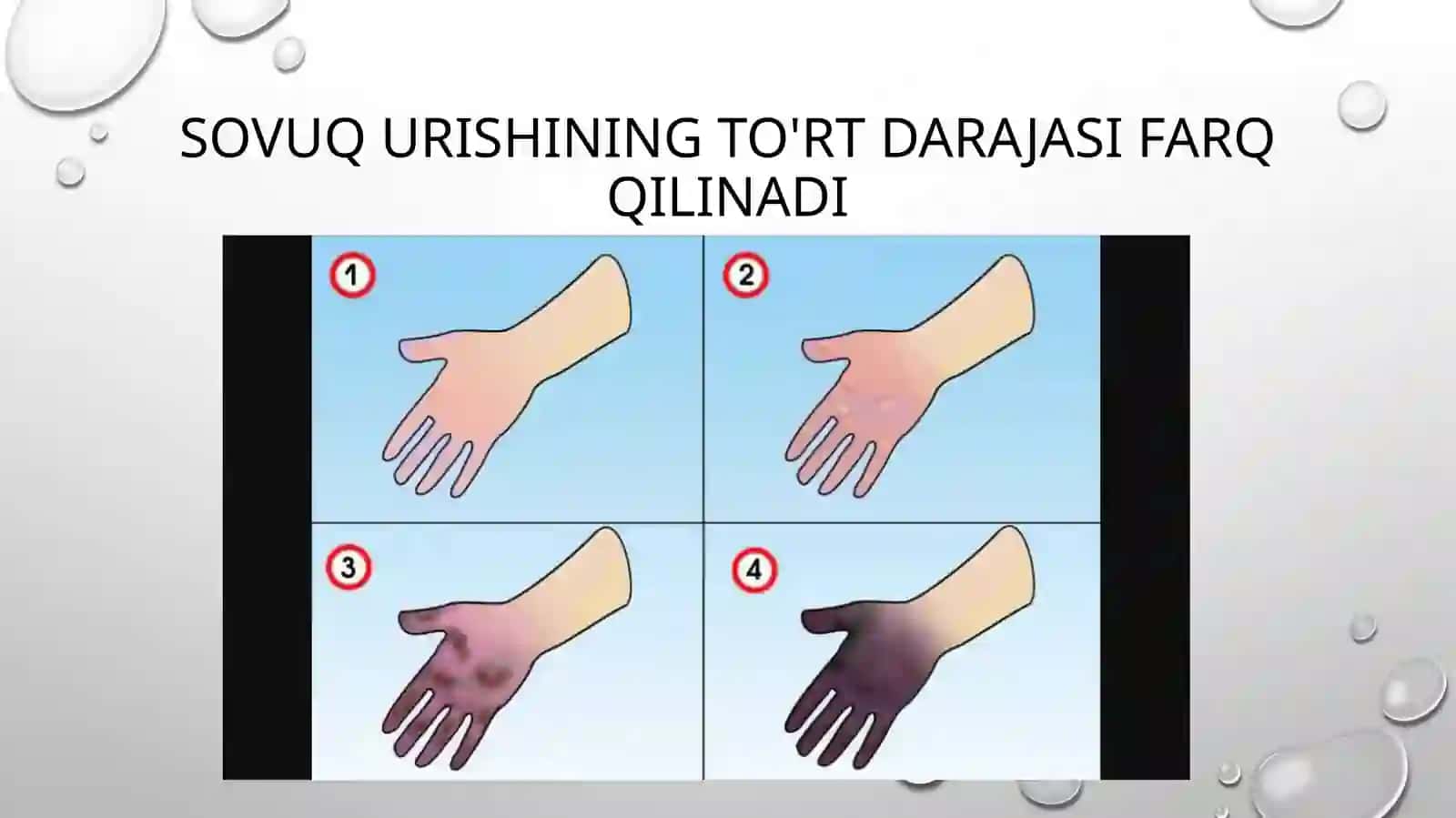 Sovuq urish belgilari 2