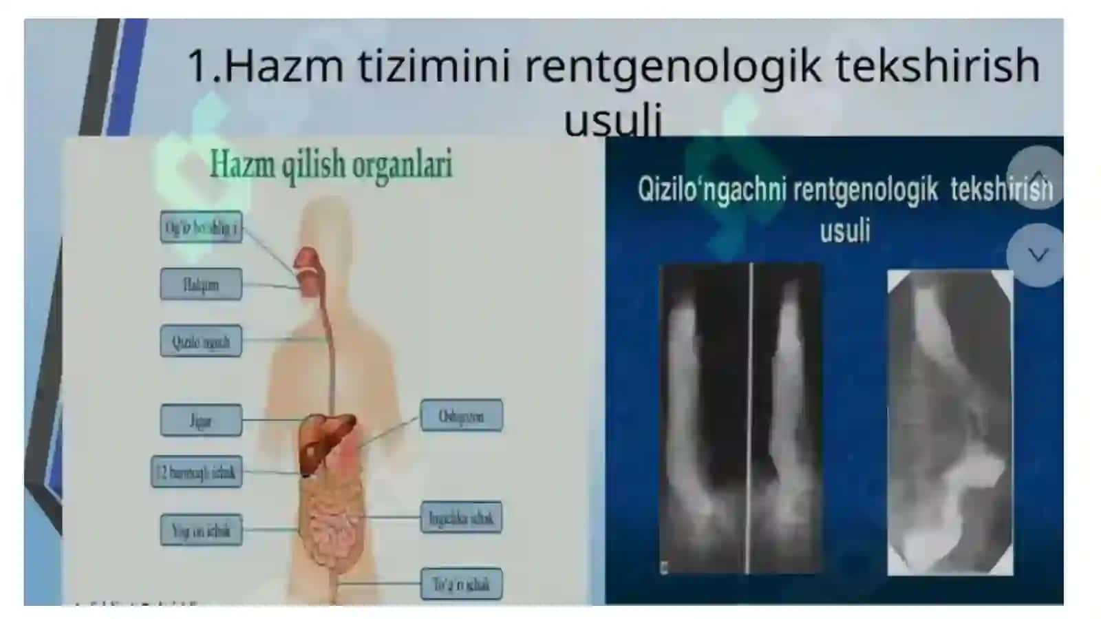 KopTarmoqli Tibbiyot Texnikumi Hamshiralikishiyonalishi114-guruhtalabasi 2