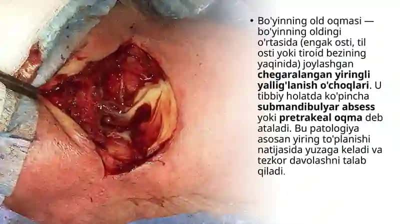 Bo'yinning old oqmasida (absses) bajariladigan jarrohlik amaliyoti 2