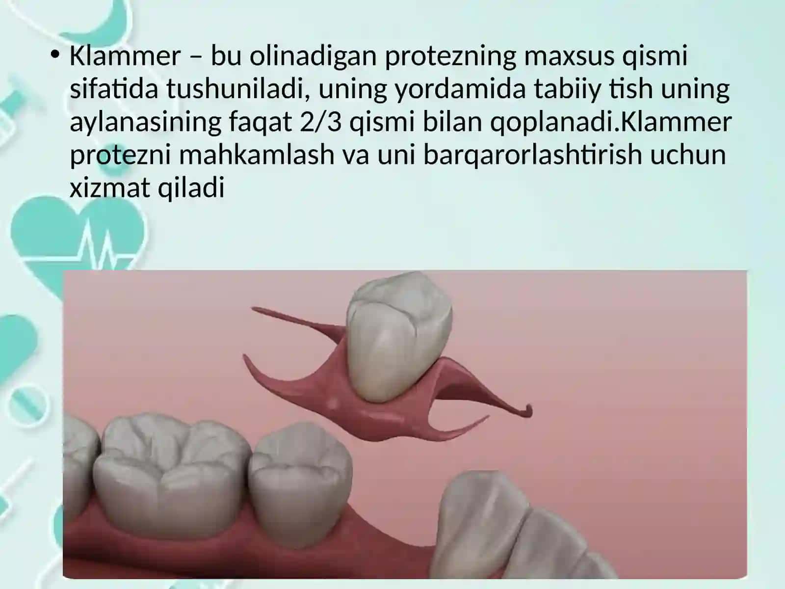 Klammer 2