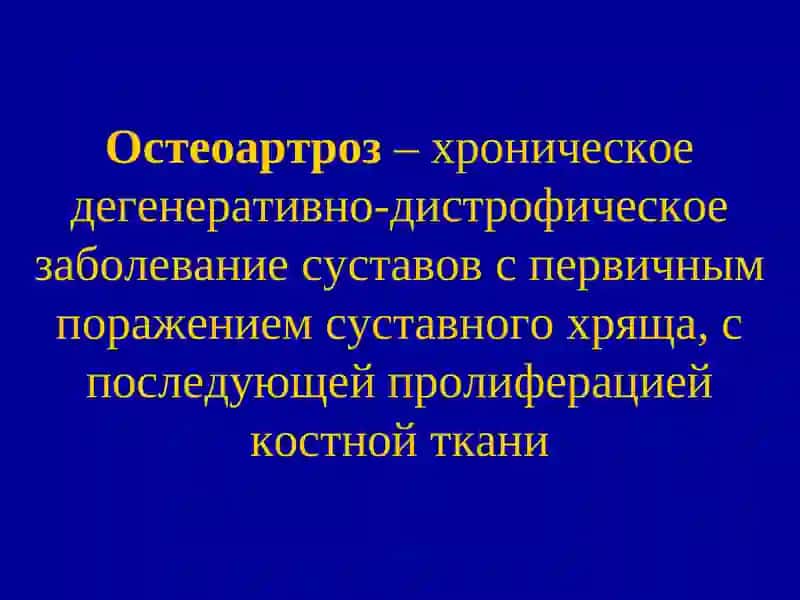 Остеоартроз 2