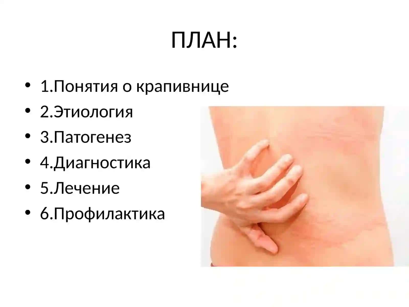Крапивница 2