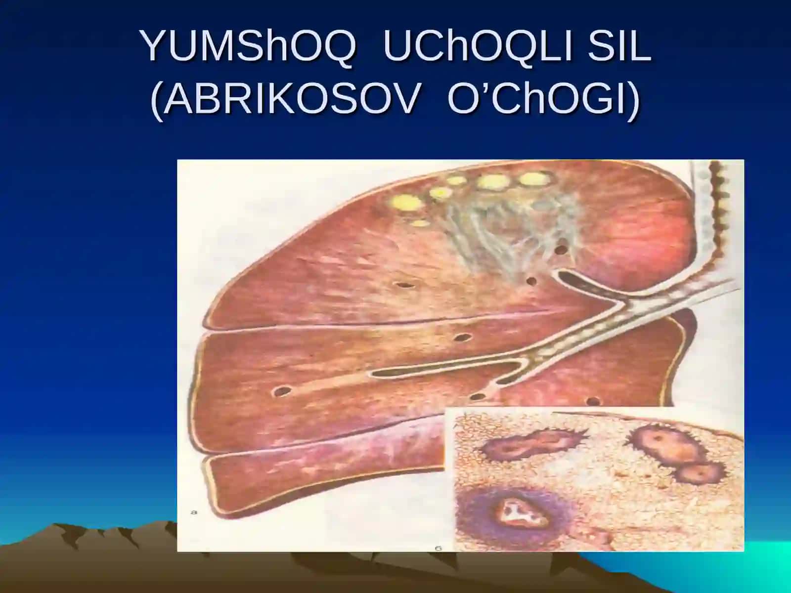 O'choqli sil 2