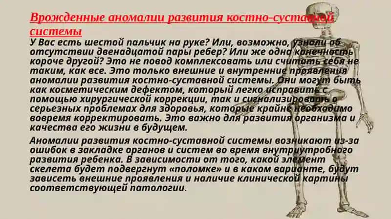 Аномалии скелета 2