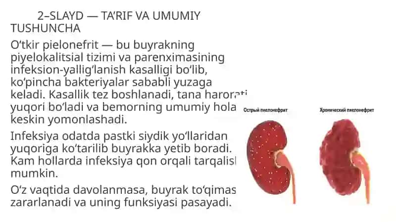 O‘TKIR PIELONEFRIT 2