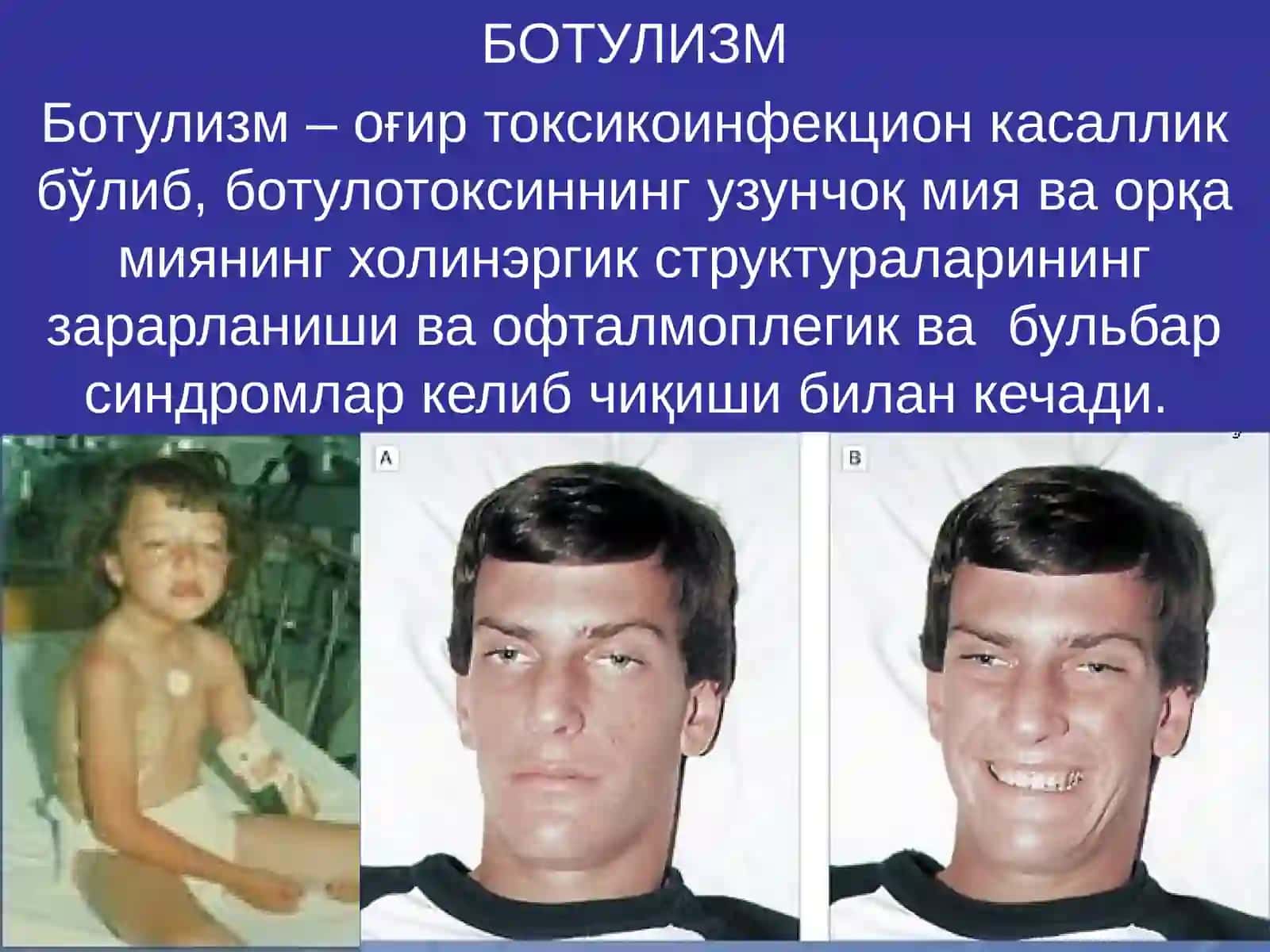 БОТУЛИЗМ 2