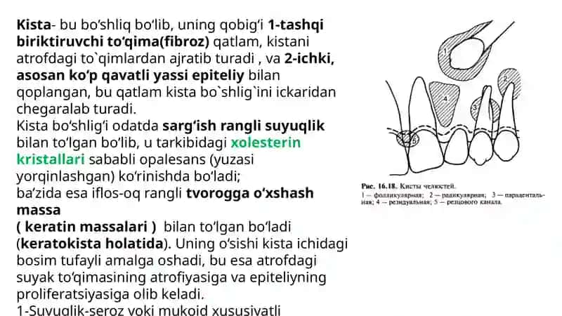 Jag` suyaklarining odontogen epitelial kistalari 2