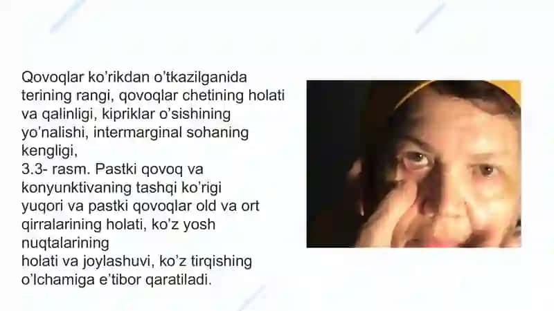 Qovoqlar ko’rikdan o’tkazish 2