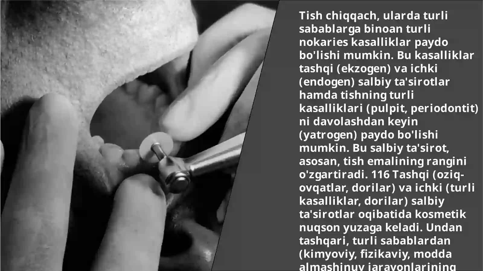 Tashqi va ichki salbiy ta'sir tomonidan to'g'ri 2