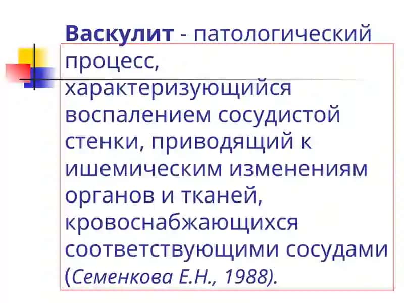 Системные васкулиты -общие положения 2