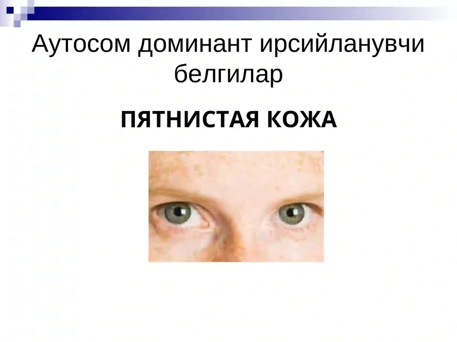 Ирсийланиш типлари 2