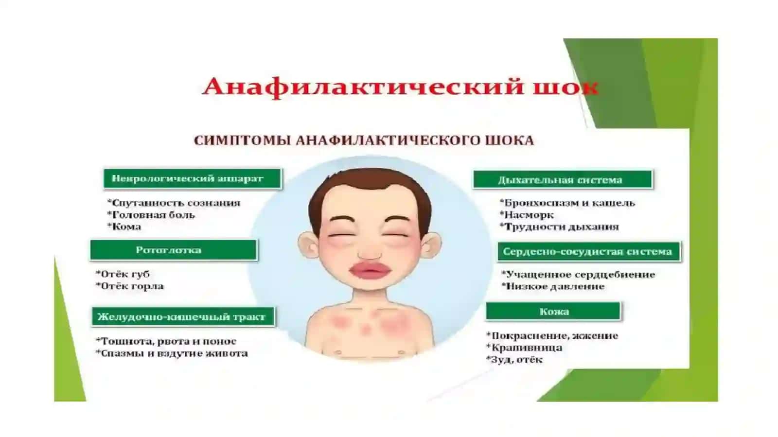 ANAFILAKTIK SHOK“103” BRIGADALARI TOMONIDAN TEZ TIBBIY YORDAM KO`RSATISH STANDARTLARI asosida tuzildi 2