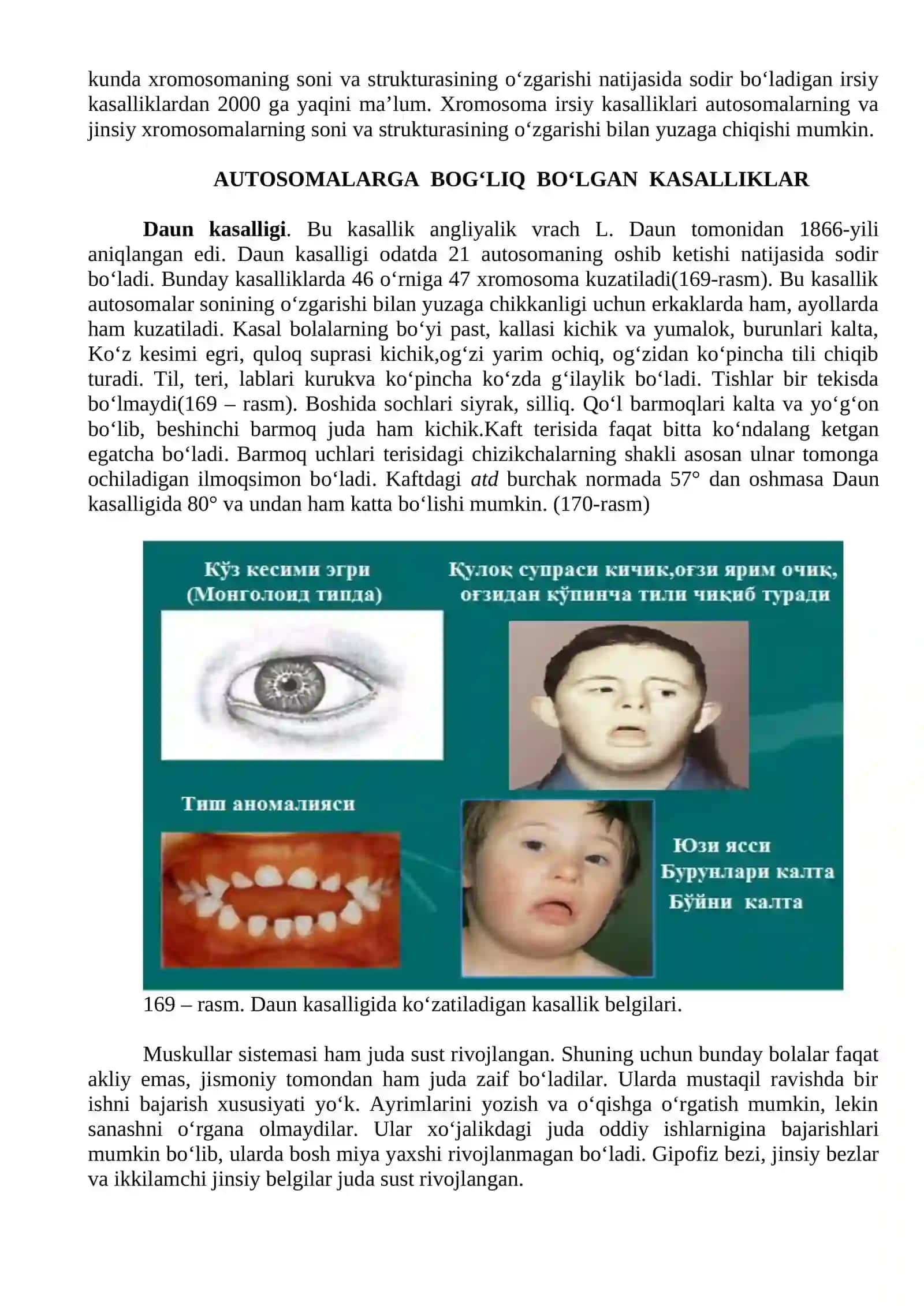 IRSIY KASALLIKLAR: XROMOSOMA KASALLIKLARI 2