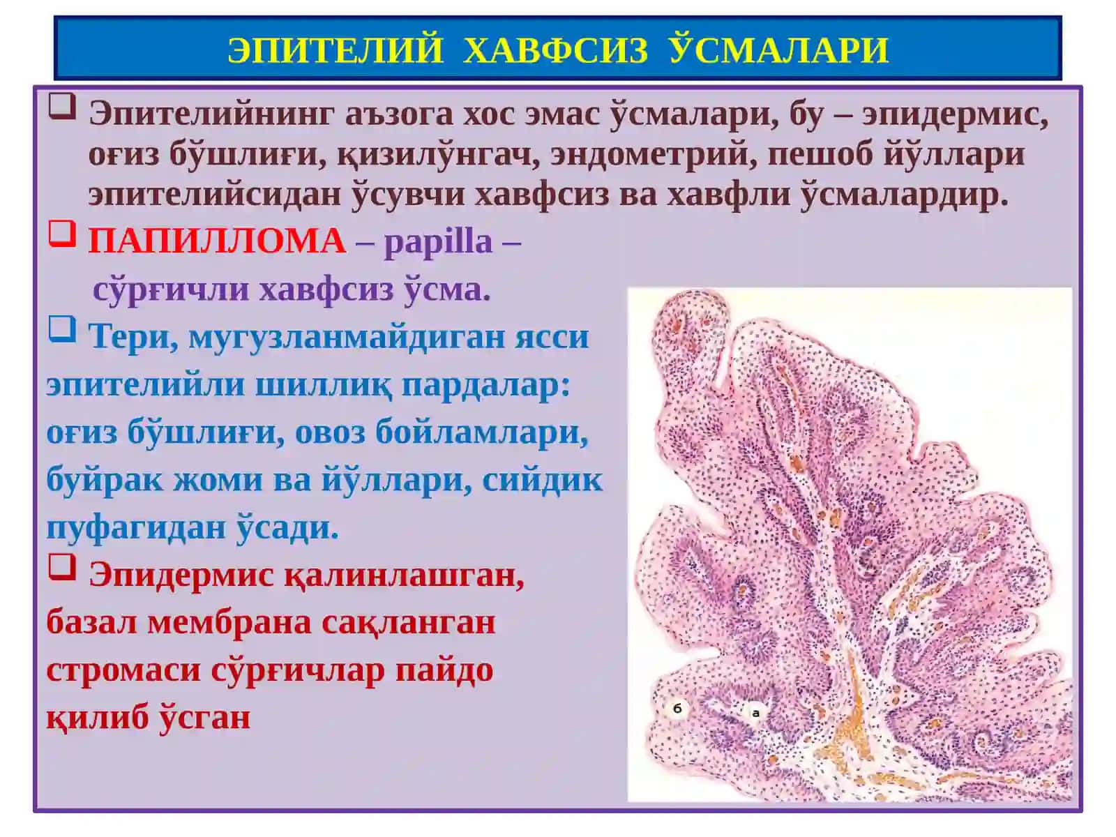 Ўсмалар.Мезенхимал ўсмалар 2