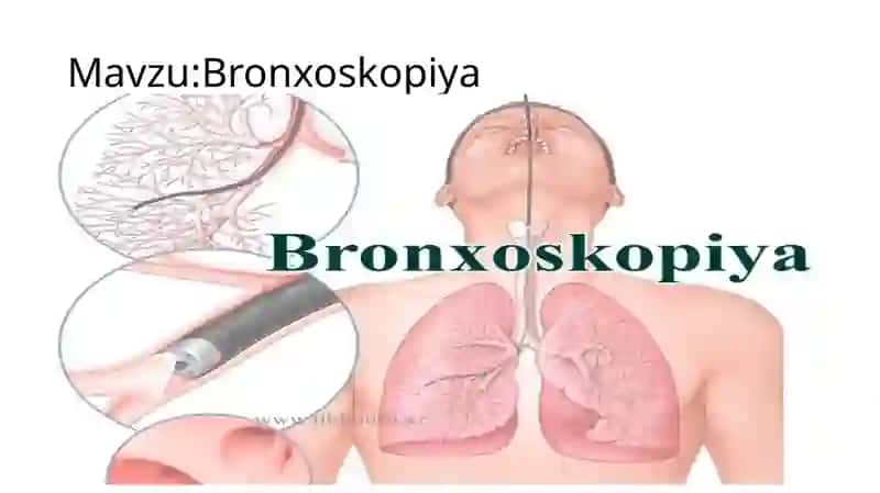 Bronxoskopiya 2