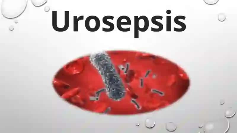 Urosepsis 2