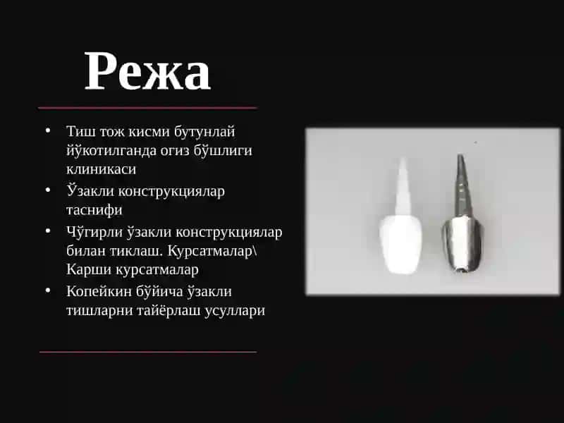 Тиш тож қисми бутунлай йўқотилганда оғиз бўшлиғининг клиникаси ва протезлаш усуллари 2