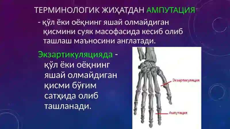Ампутация ва экзартикуляция 2