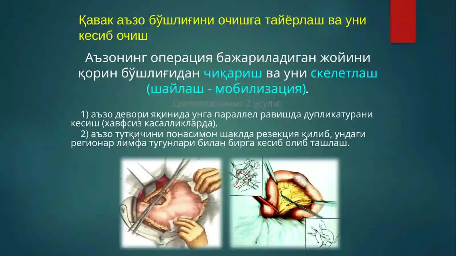 ОПЕРАТИВ ЖАРРОҲЛИК 2