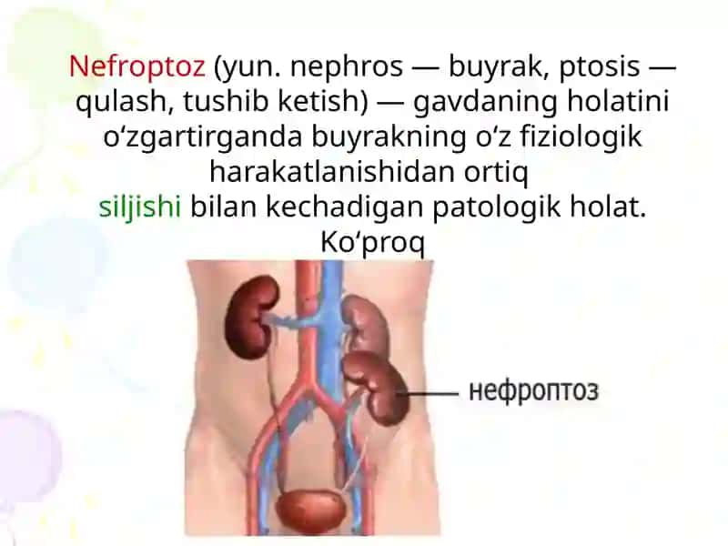 Nefroptoz 2