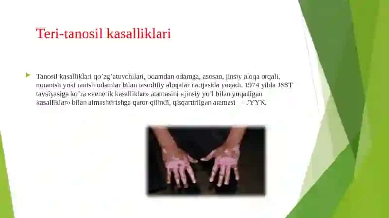 Tanosil kasalliklar 2