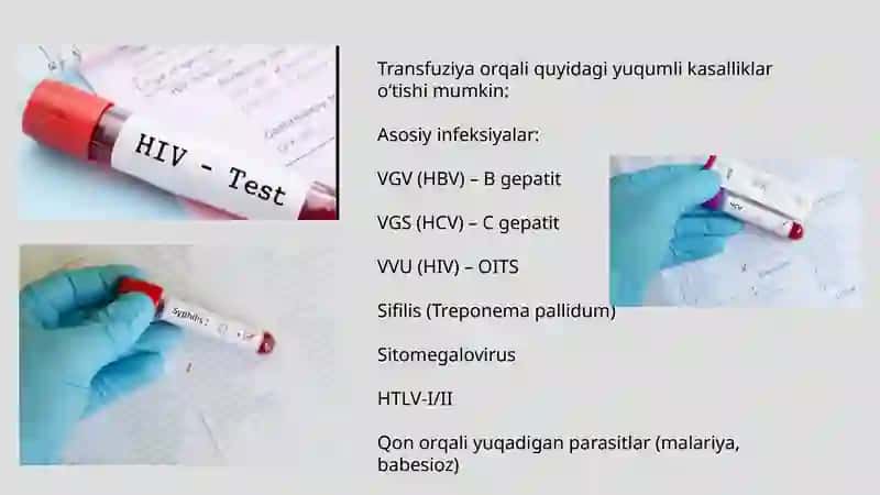 Qon quyish paytida zahm infeksion asoratlari: sabablari, klinikasi, tashxisi va oldini olish 2