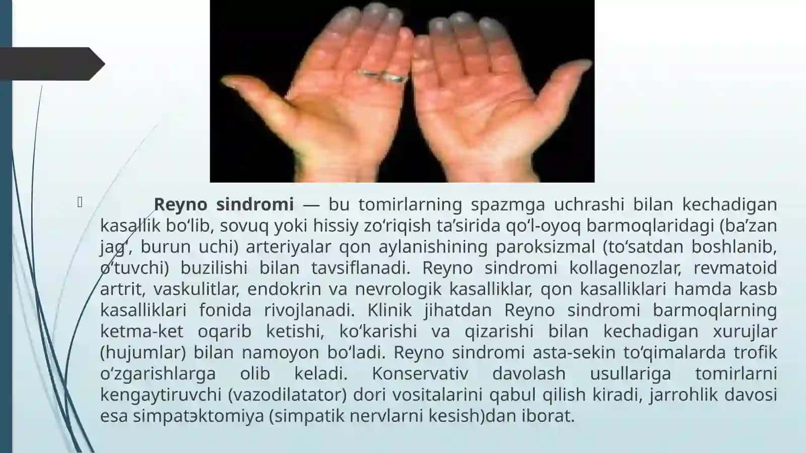 Reyno kasalligi, Byurger kasalligi 2