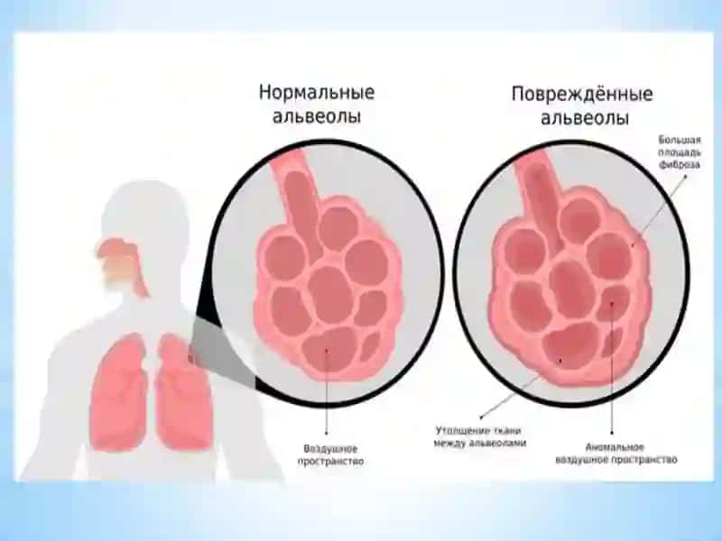 Allergikal veolit būlalarda 2