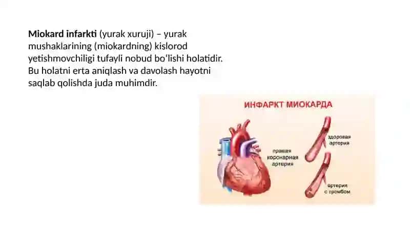Miokard infarktining erta va kech biokimyoviy tashxisi 2