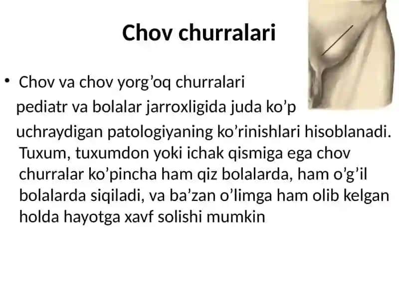 Chov churralari 2