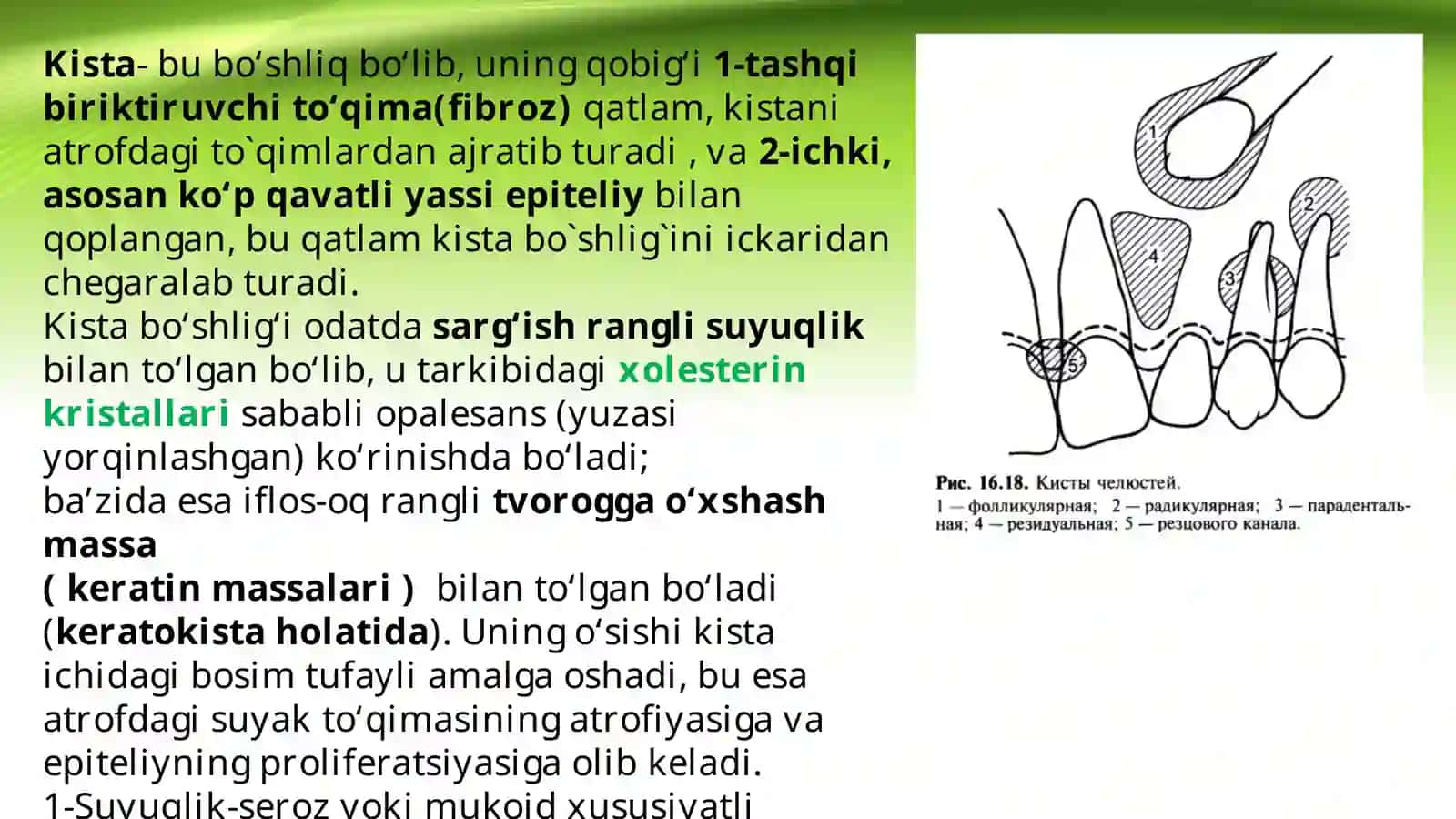 Jag` suyaklarining odontogen epitelial kistalari 2