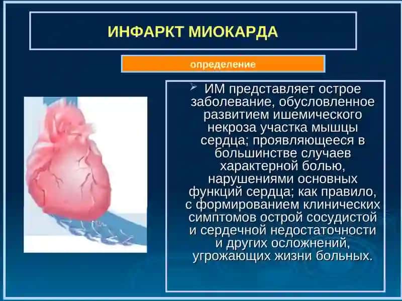 Miokard infarkti 2