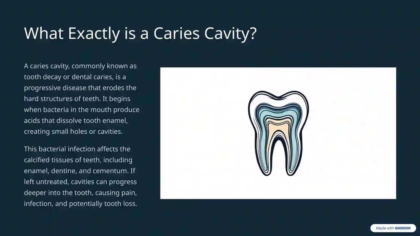 Understanding Caries Cavity: From Formation to Prevention 2