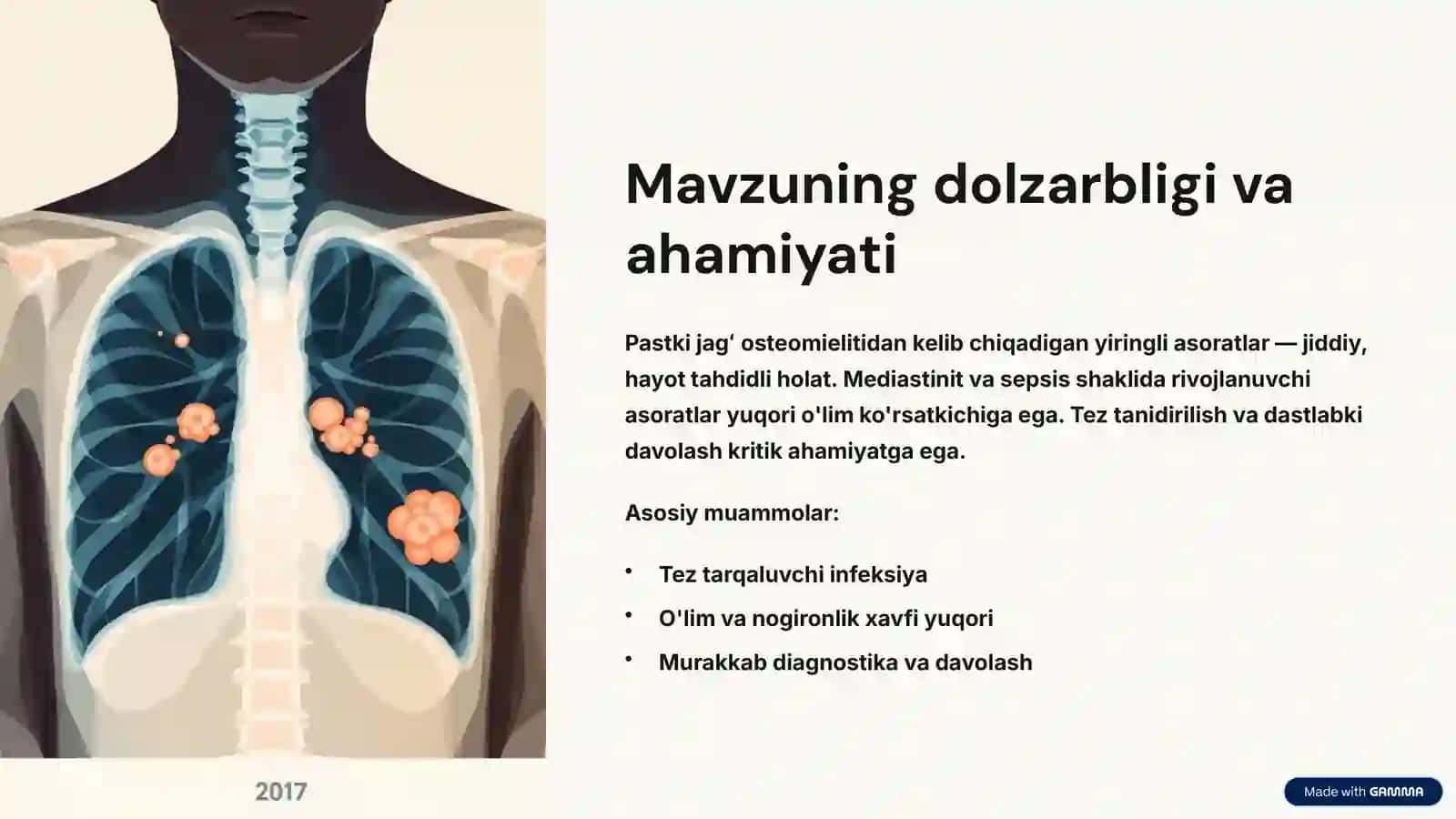 Pastki jagʻ osteomielitida boʻyin va koʻks atrofidagi tarqalgan yiringli asoratlar 2
