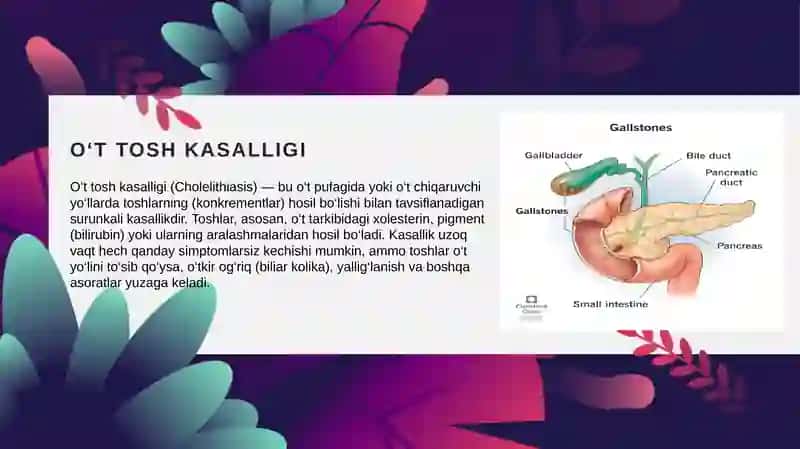o't tosh kasalligi 2