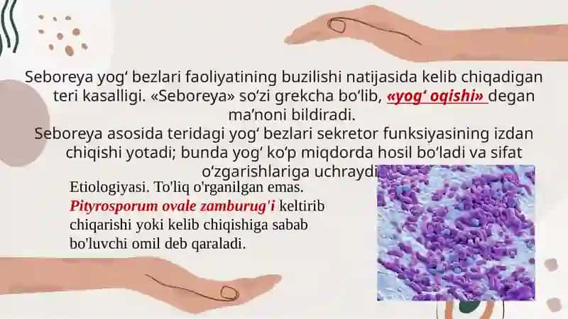Seboreyali dermatit 2