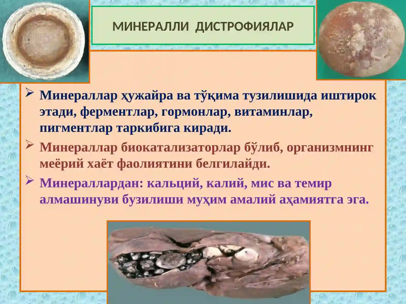 Минераллардан: кальций, калий, мис ва темир алмашинуви бузилиши муҳим амалий аҳамиятга эга 2