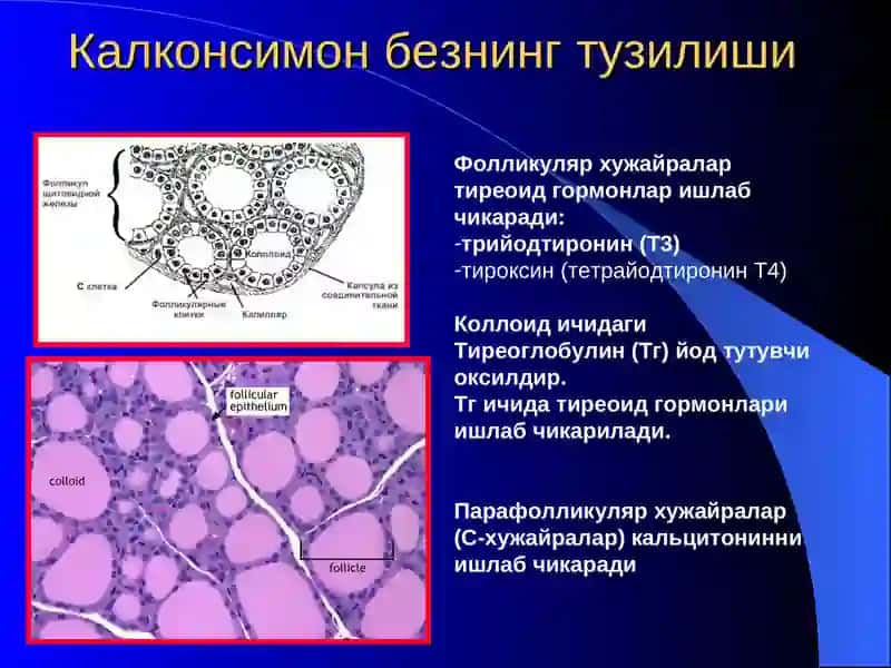 Гипотиреоз синдроми 2