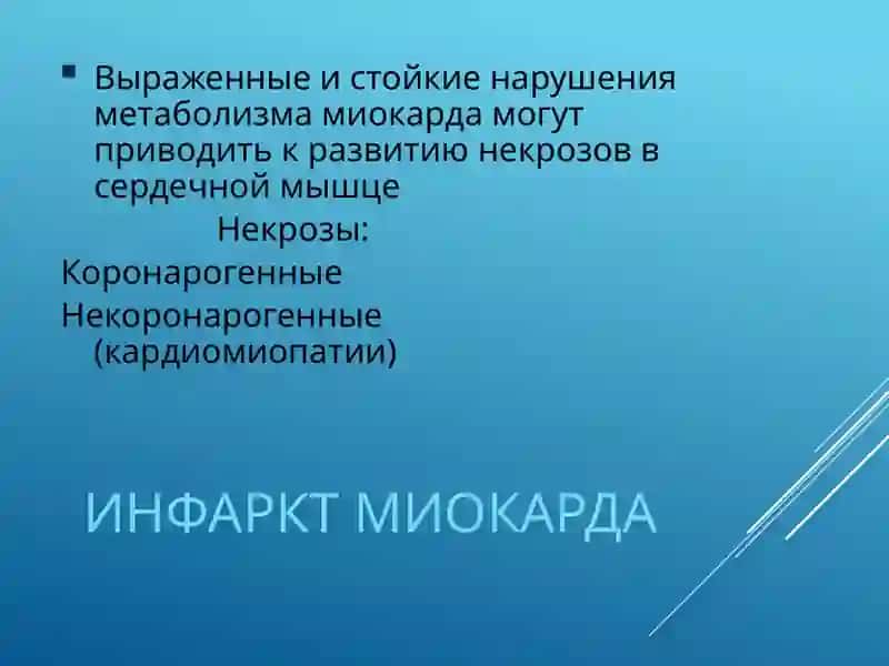 Инфаркт миокарда 2