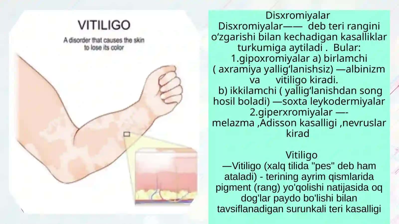 Vitiligo kasalligi 2