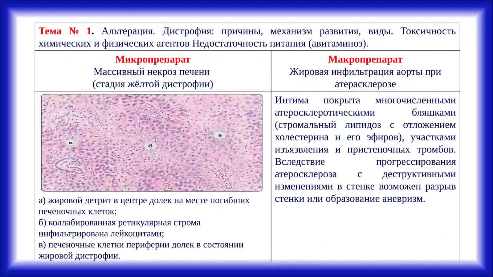 АЛЬТЕРАЦИЯ. ДИСТРОФИЯ 2