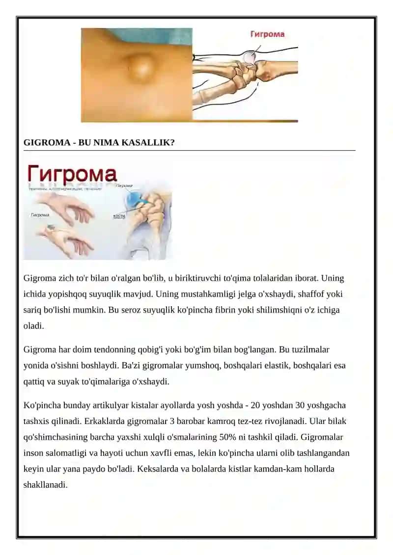 Gigroma 2