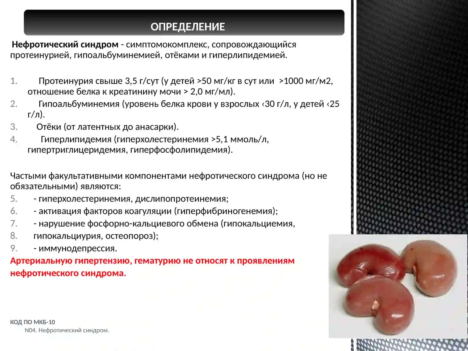Нефротический синдром 2