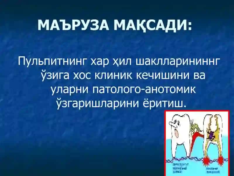 Пульпитнинг хар ҳил шаклларининнг ўзига хос клиник кечишини ва уларни патолого-анотомик ўзгаришларини ёритиш 2
