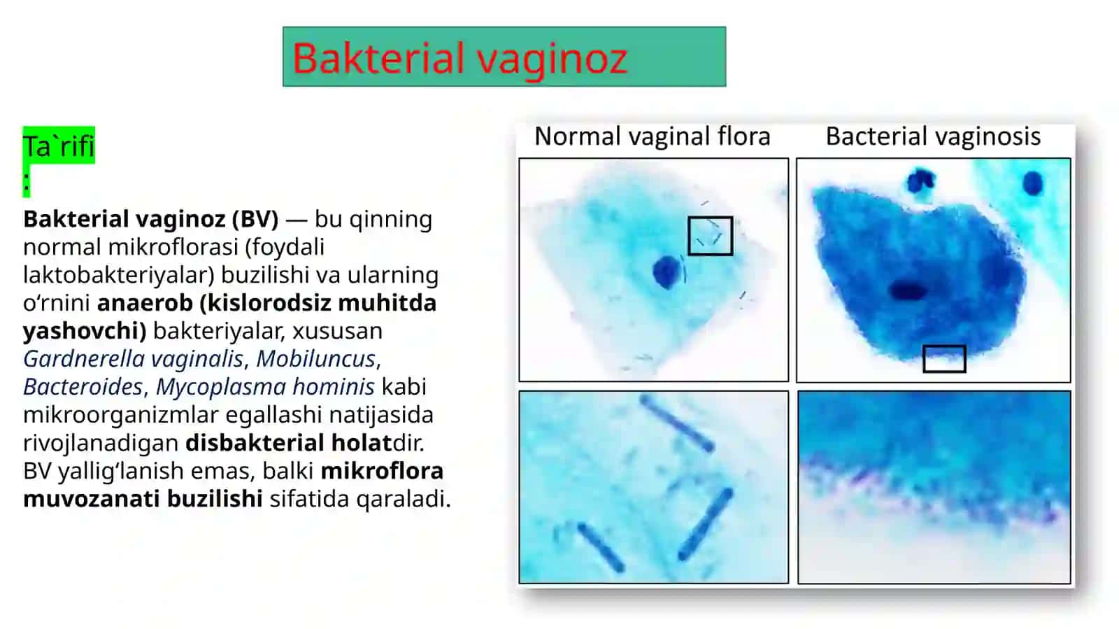 Bakterialvaginoz, Mikoplazmoz, Ureaplazmoz 2
