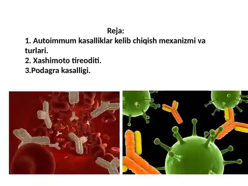 Autoimmun kasalliklar 2